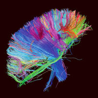 muse